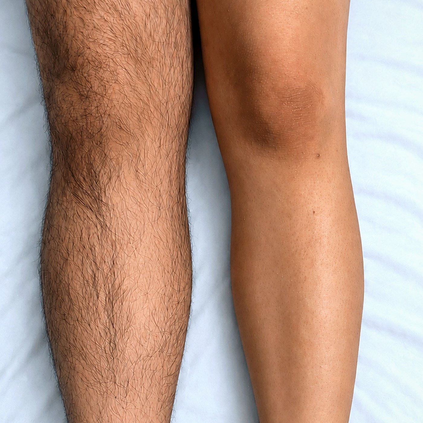 Leg waxing before and after at Get Set Salon